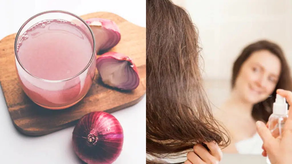 Advantages+and+Side+Effects+of+Onion+Juice+on+Hair