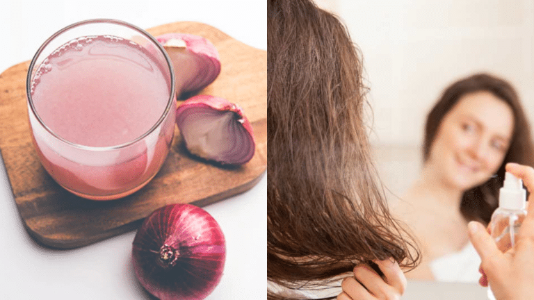 Advantages+and+Side+Effects+of+Onion+Juice+on+Hair
