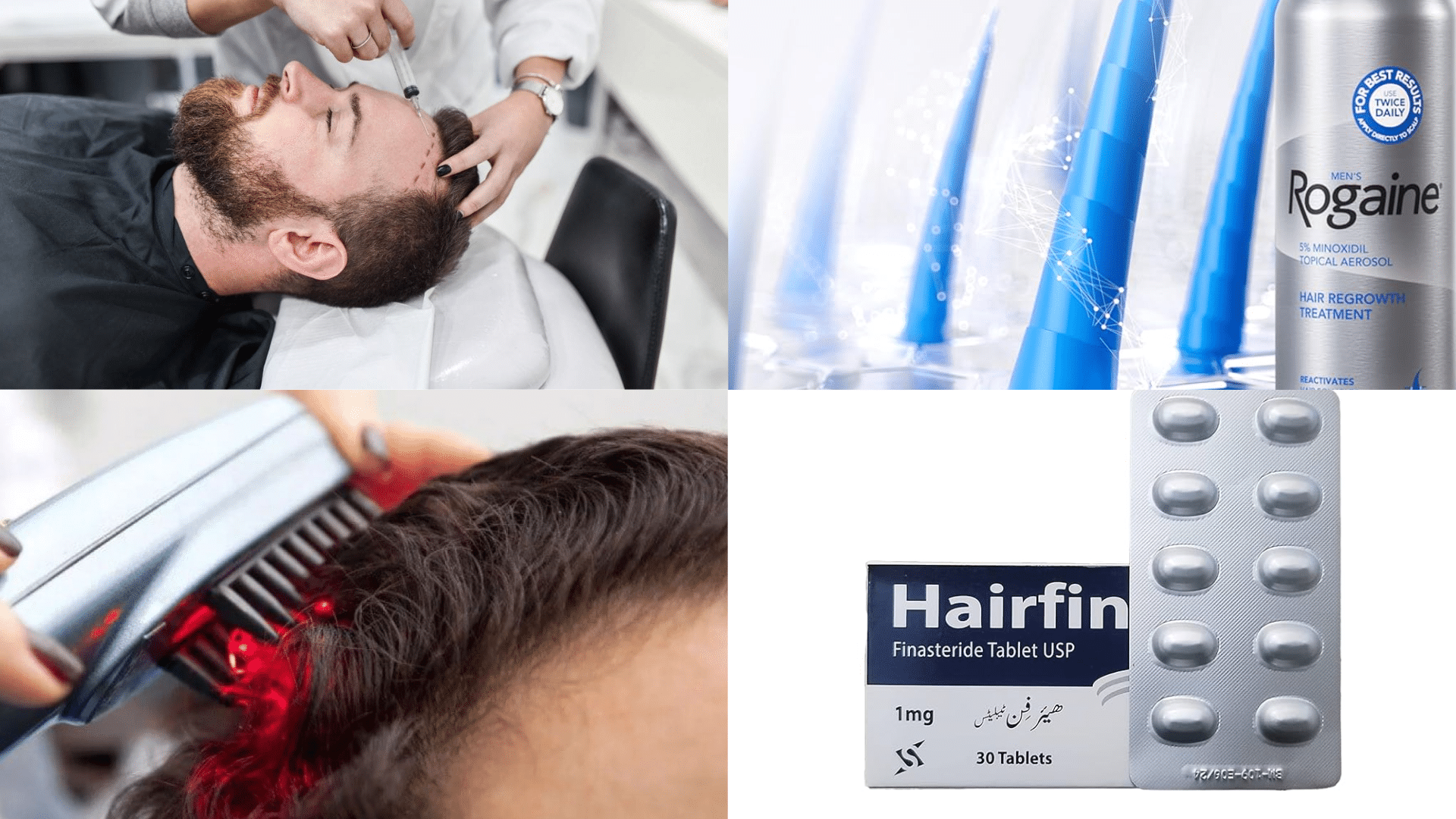 Alternative Treatments Compared to PRP