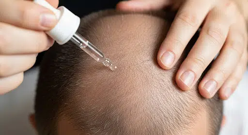 How to Reduce Side Effects of Finasteride Safely