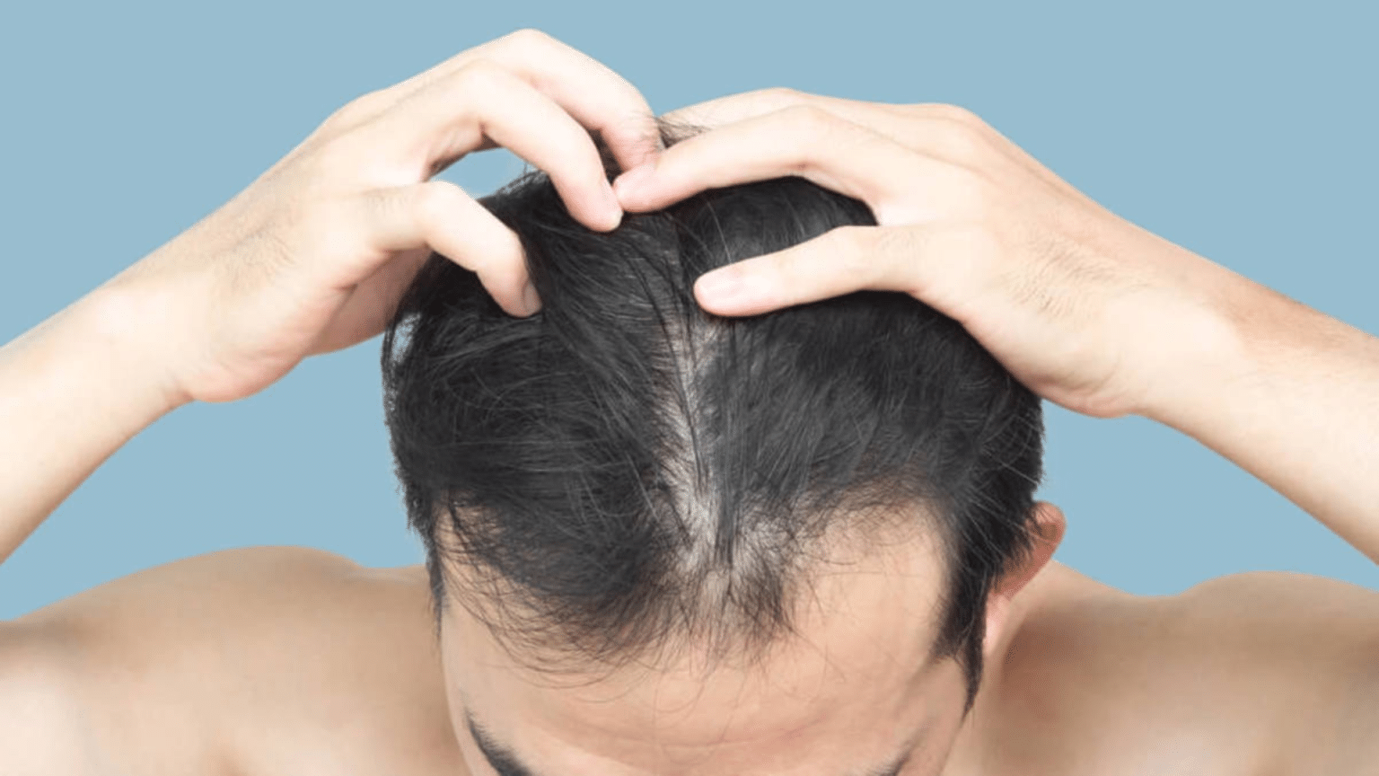 What Happens If You Stop Using Minoxidil? - Stemsontx