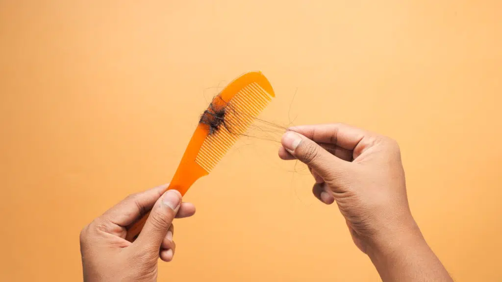 Managing Phentermine Hair Loss with the right steps