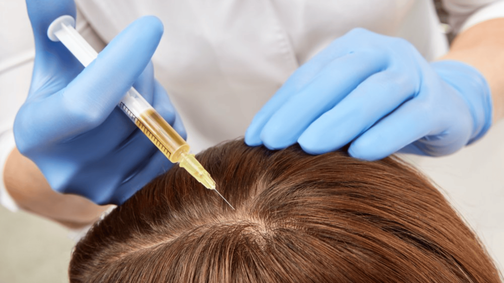 PRP-Therapy (1)