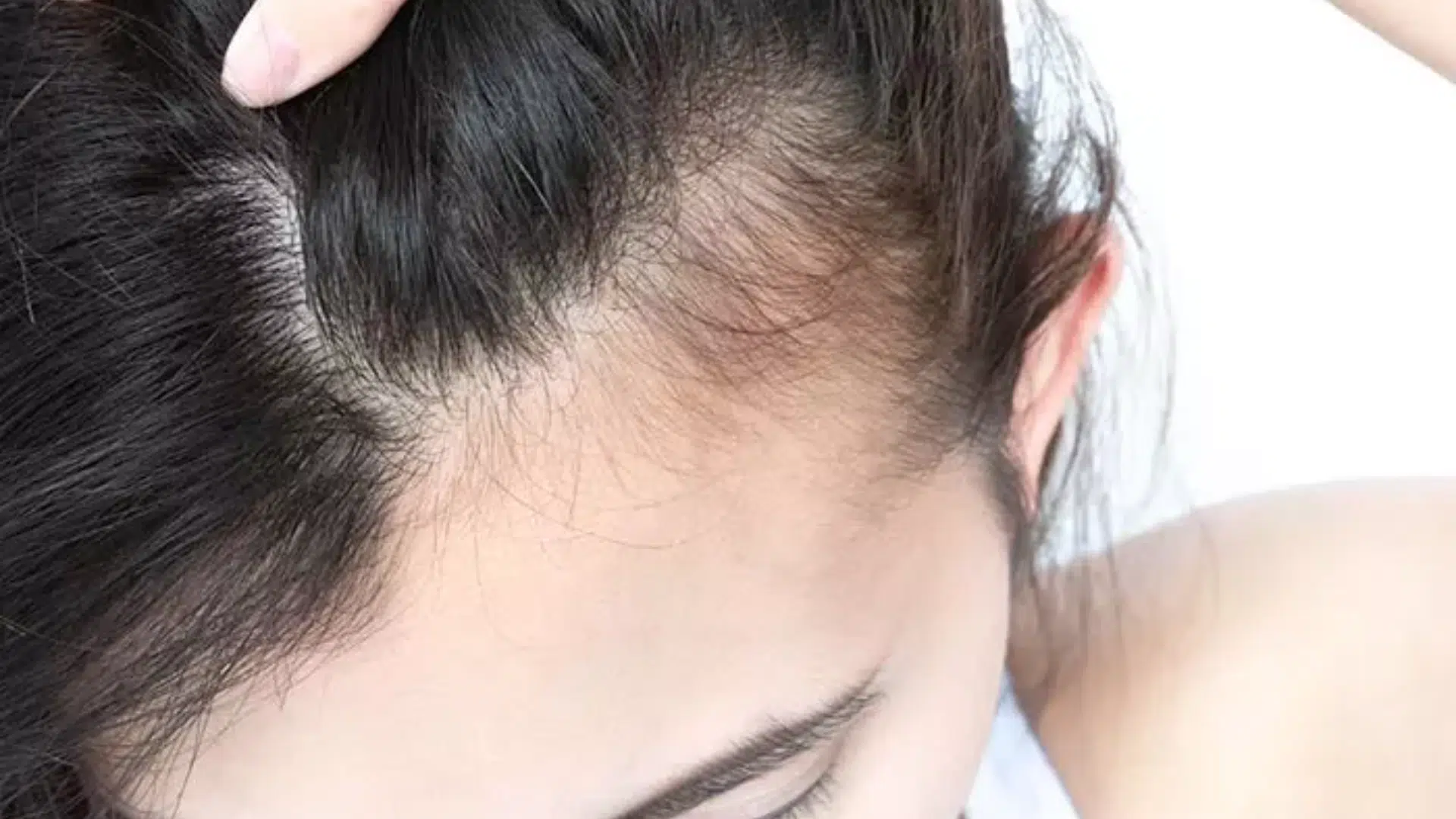 Signs of New Hair Growth on Scalp