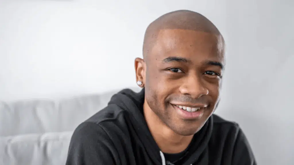 What-Does-Your-Scalp-Micropigmentation-Fee-Cover