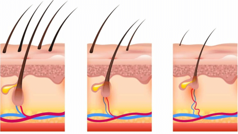 What Happens If You Stop Using Minoxidil? - Stemsontx