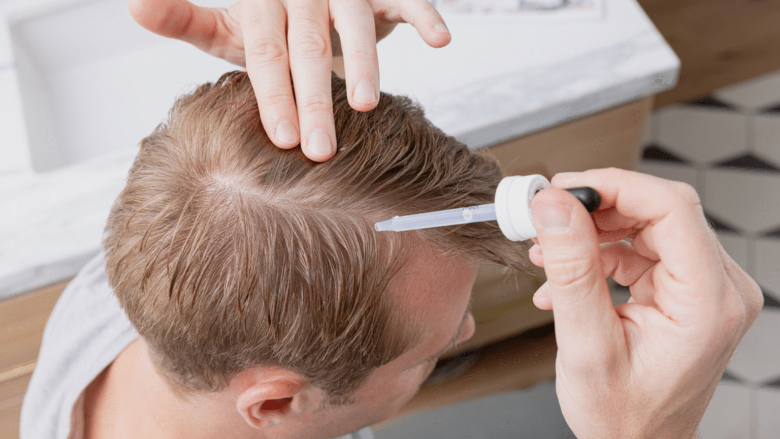 What Happens If You Stop Using Minoxidil?