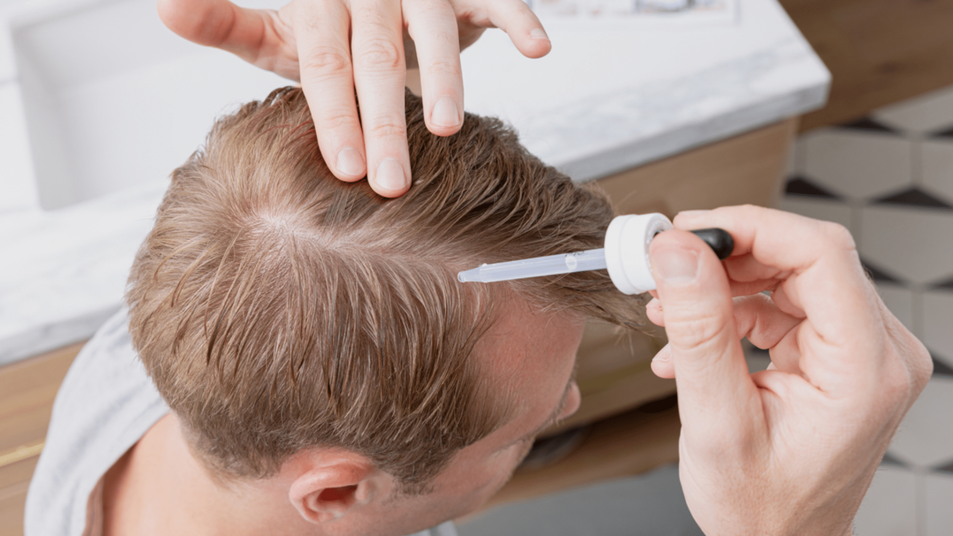 What Happens When You Stop Using Minoxidil