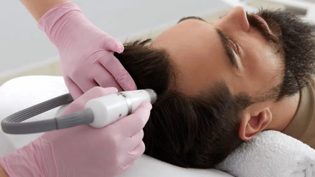 non-surgical-hair-transplant