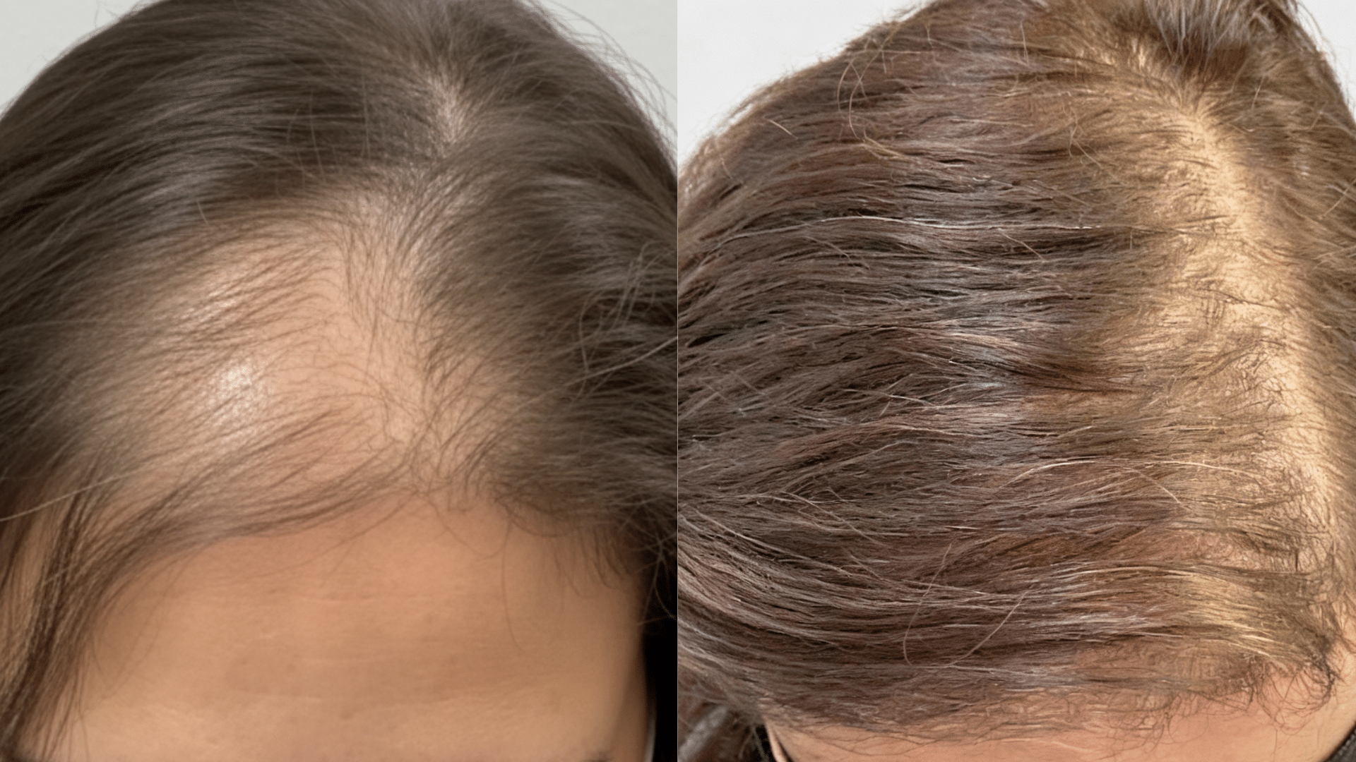 29-Year-Old Marketing Manager