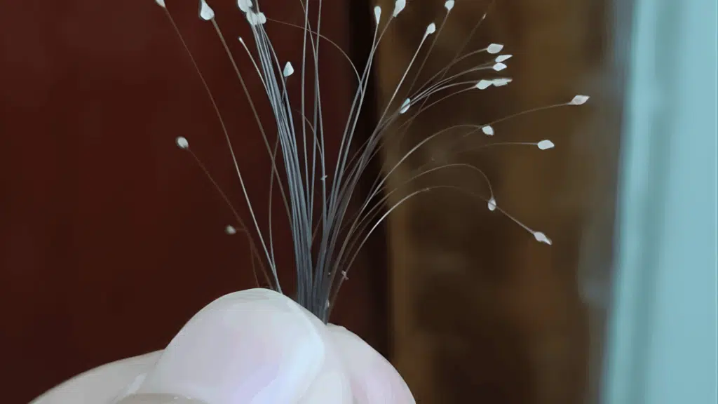 what does a white bulb at the end of hair indicate