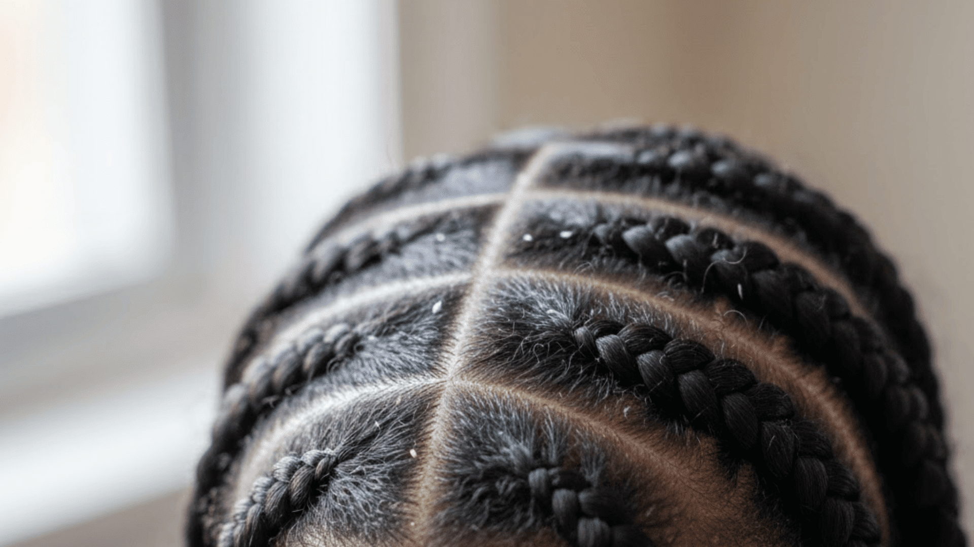Can Black People Have Lice with Braids?