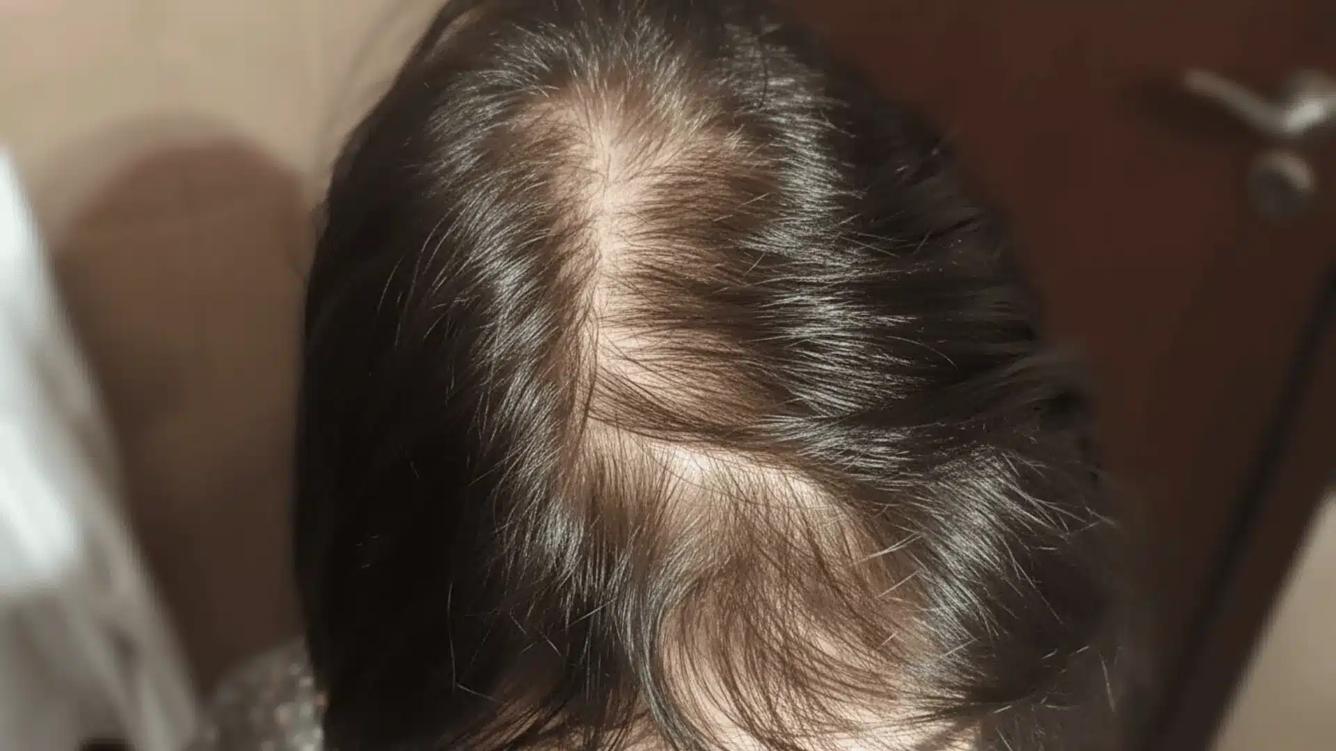 A close-up shot of a woman in a bathroom, focusing on thinning hair on the top of her head due to hrt as she looks at her reflection
