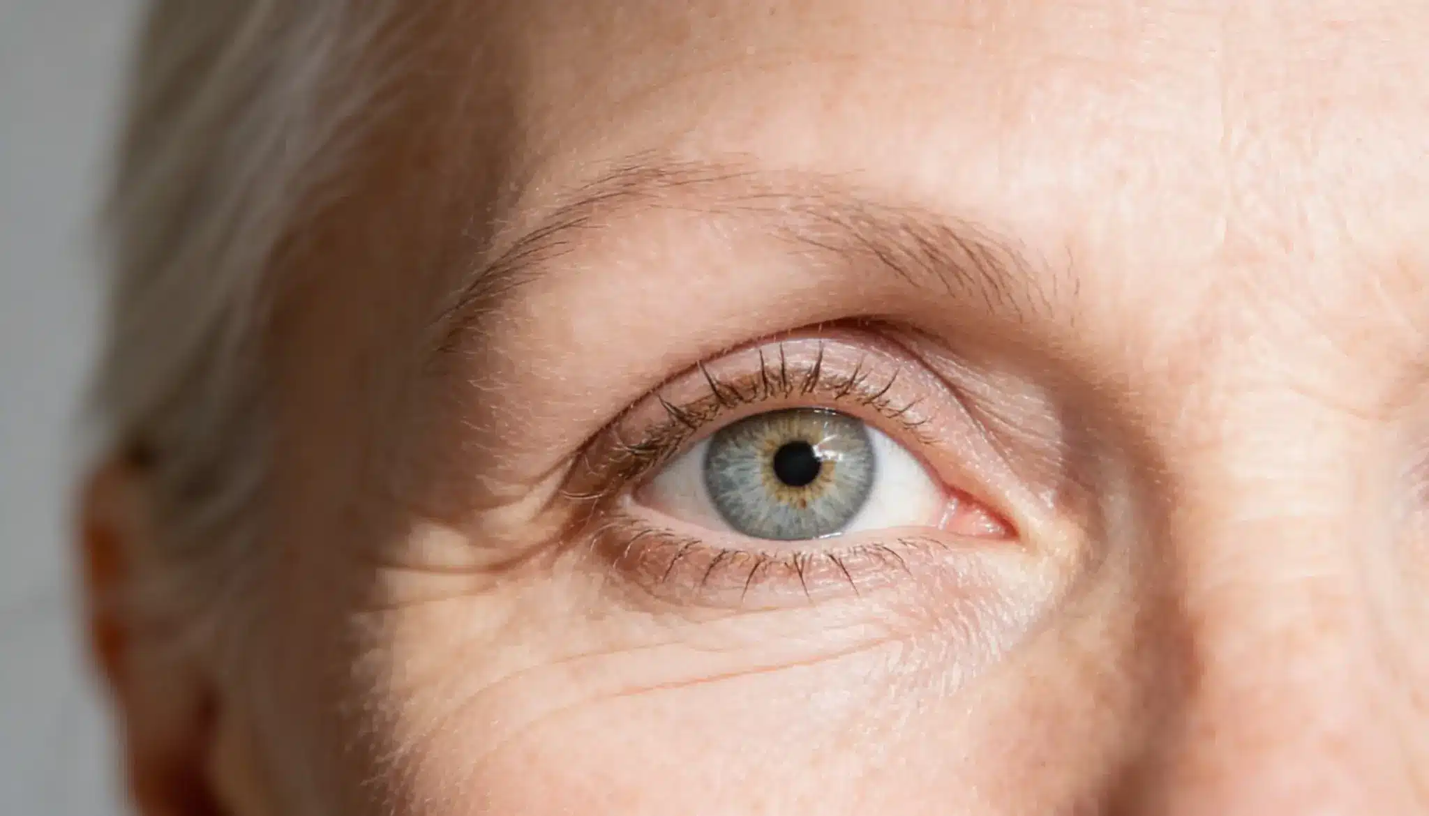 A Close-up of an older woman's eye, highlighting eyebrow thinning caused from androgenetic alopecia