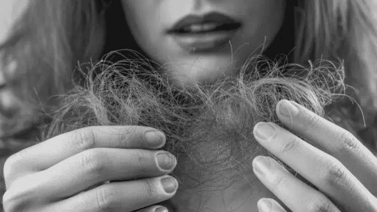 Woman holding a clump of light brown shed hair in her hands with a concerned expression, planning to get hair pull test done.