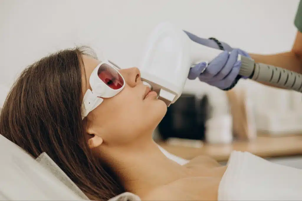 Is Upper Lip Laser Hair Removal Safe for Sensitive Skin?