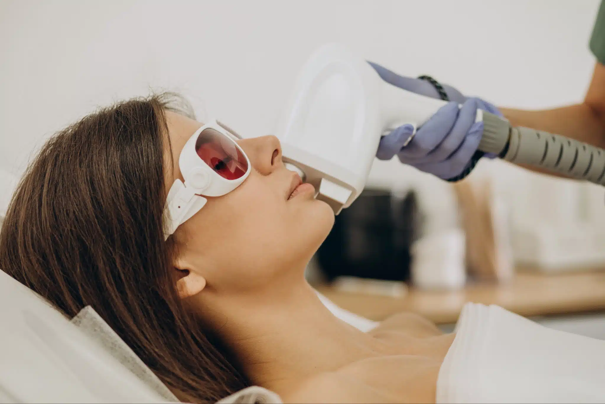 Is Upper Lip Laser Hair Removal Safe for Sensitive Skin?