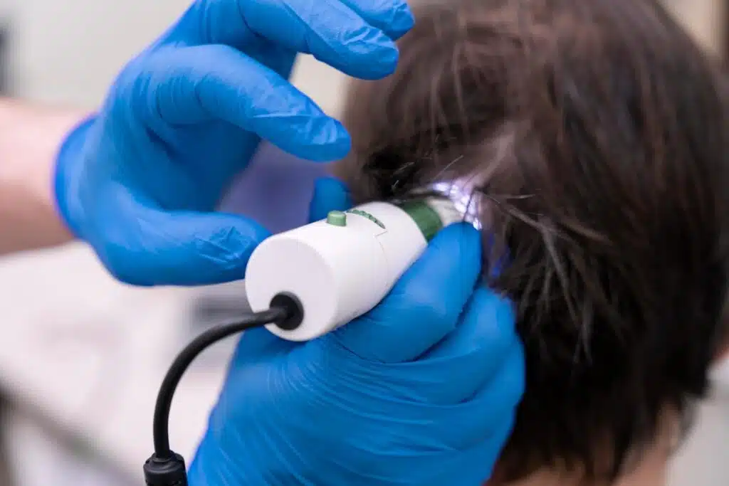 Safe Ways to Use Hair Growth Devices