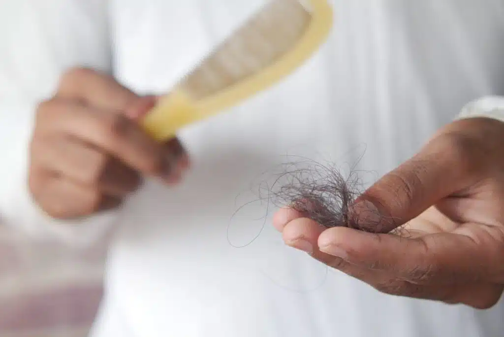 Does Marijuana Cause Hair Loss?