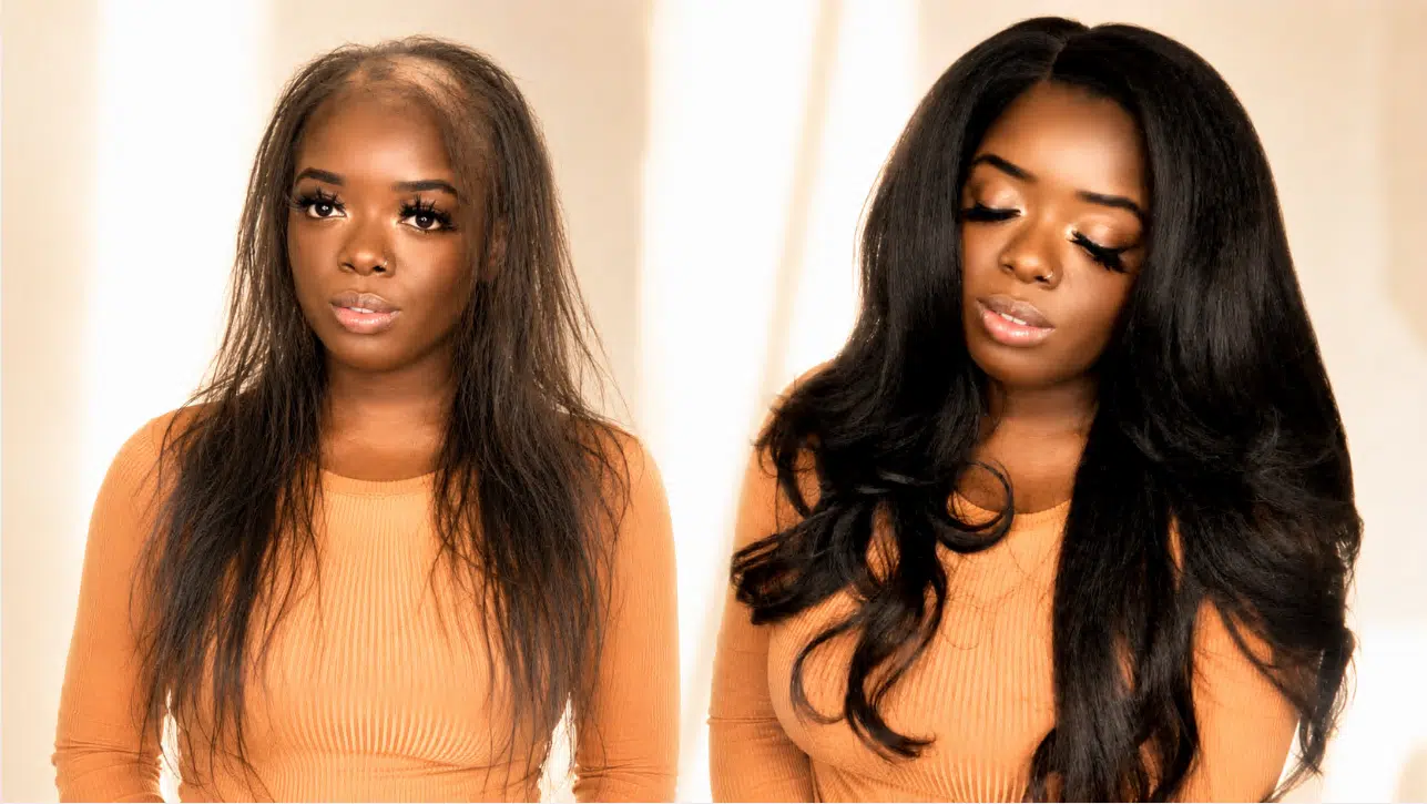 How Wigs Help Black Women Manage Hair Thinning Discreetly