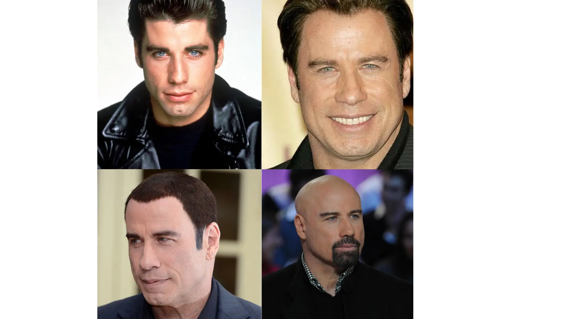 A collage showing john travolta's hairline changes over the years.